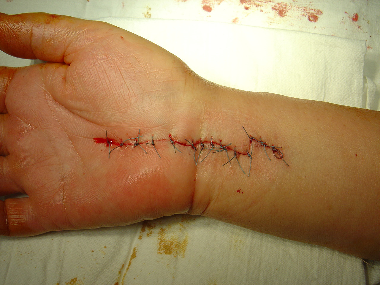 chirurgie clasica1