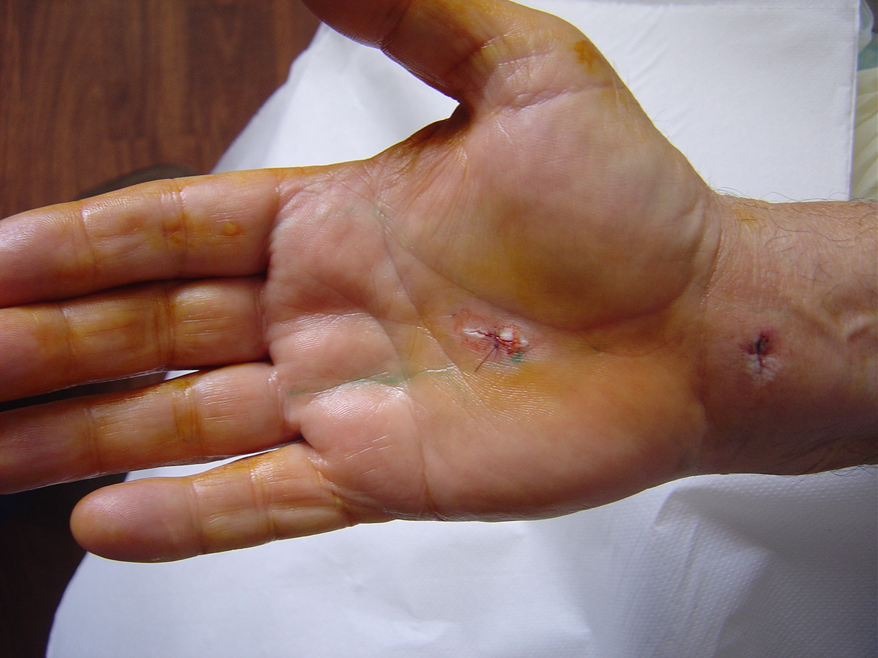 chirurgie endoscopica
